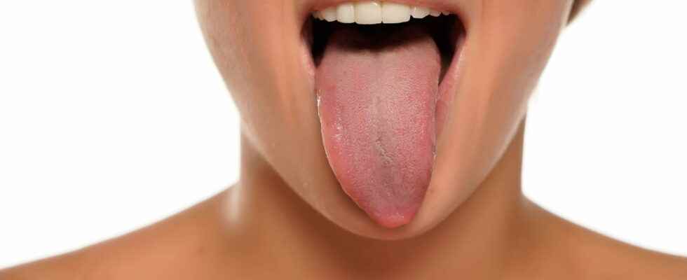 The 7 warning symptoms of oral cancer