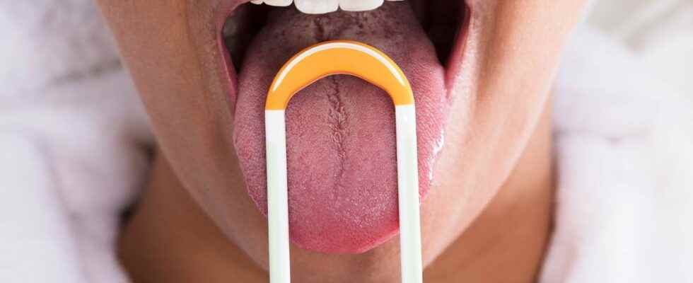 Tongue scraping is this Tik Tok trend useful for oral