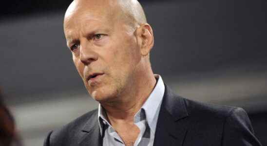 Aphasia Bruce Willis disease worsens