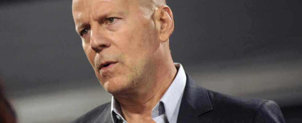 Aphasia Bruce Willis disease worsens