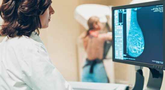 Breast cancer a platform now brings together all French clinical