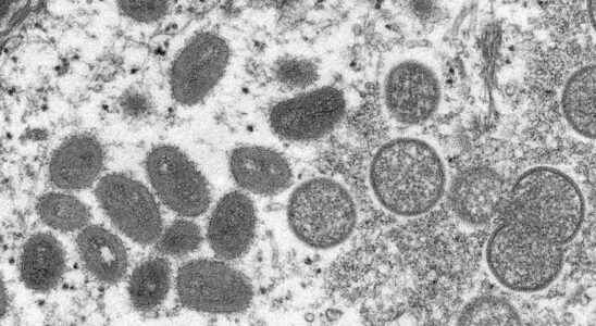 Covid 19 Mpox avian flu… The decline of biodiversity threatens us