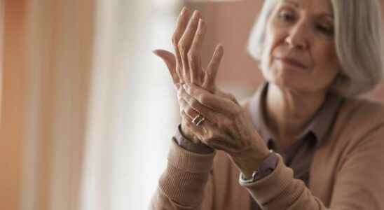 Hand osteoarthritis towards a hopeful drug