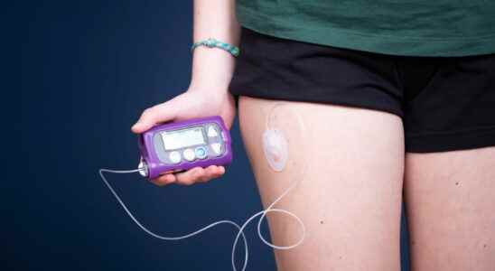 Insulin pump for whom how does it work