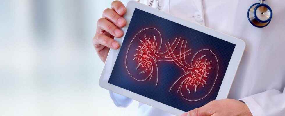 Kidney transplant the shortage of Belatacept entails real risks for