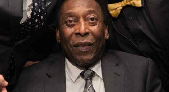 Pele is dead the king died at 82