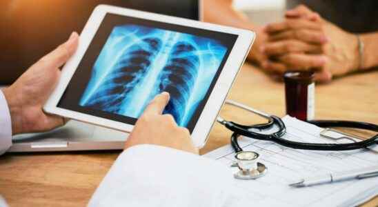 Soon an electronic nose capable of detecting lung cancer