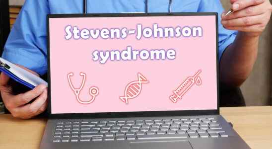 Stevens Johnson syndrome symptoms what is it