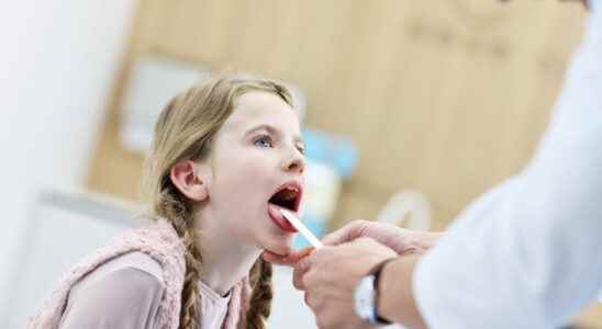 Strep throat A symptoms what is it