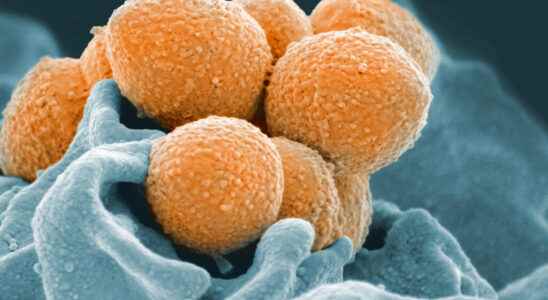 a resurgence of serious streptococcal A infections which raises questions
