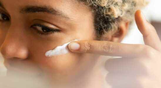 Acne be careful aspirin is not a dermatological remedy