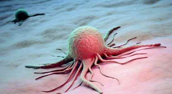 Brain cancer a study turns cancer cells into a real