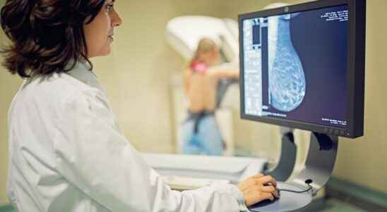 Breast cancer artificial intelligence enables better diagnosis