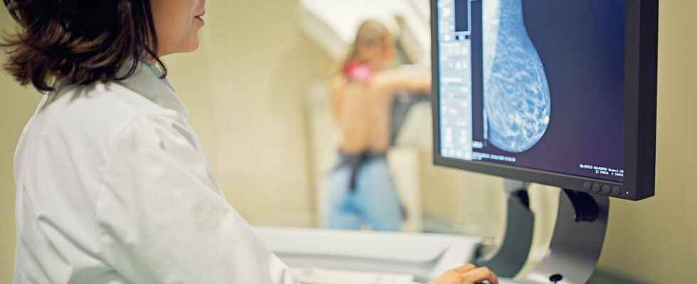 Breast cancer artificial intelligence enables better diagnosis