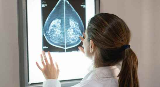 Breast cancer this risk factor that is too little known