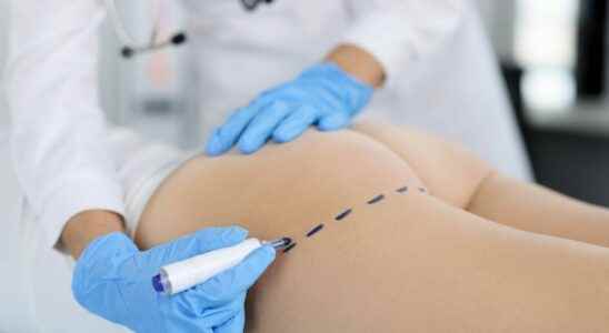 Buttock prosthesis Jessica Thivenin reveals to suffer from chronic pain