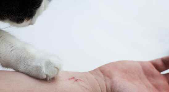 Cat scratch disease symptoms cause treatment