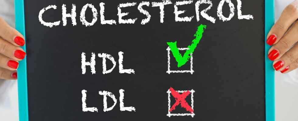 Cholesterol total LDL HDL high low what is it