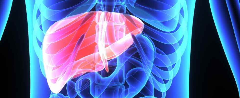 How to treat hepatomegaly liver
