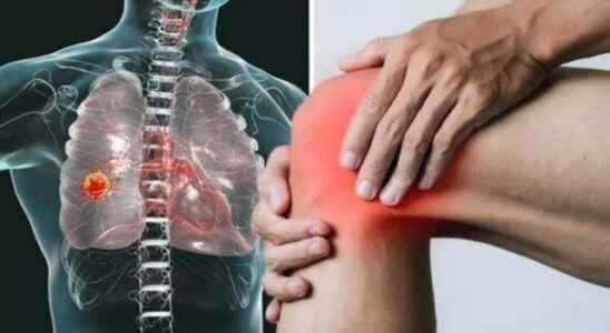 If you are experiencing knee pain do not waste time