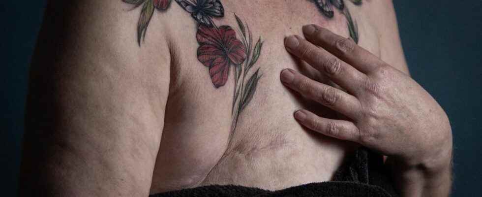 In the Netherlands a free tattoo for survivors of breast