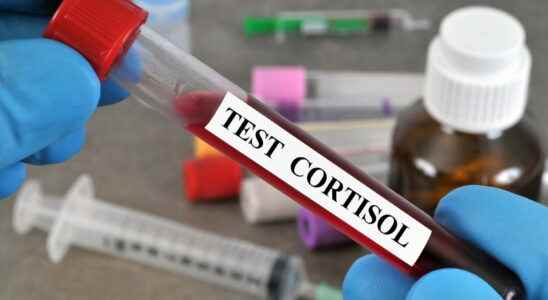 Low high cortisol in the blood standards what to do