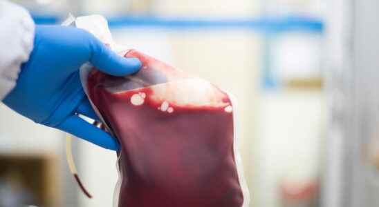 Tainted Blood Scandal Summary Number of Victims