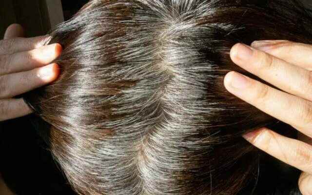 You will completely get rid of white hair naturally We