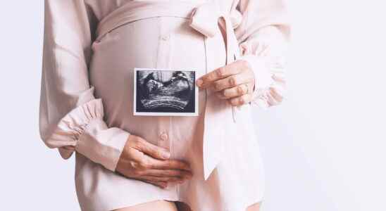 20 weeks of pregnancy 22 weeks the 2nd ultrasound