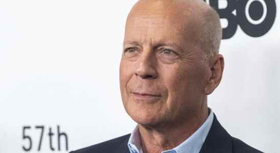 American actor Bruce Willis suffers from an incurable form of