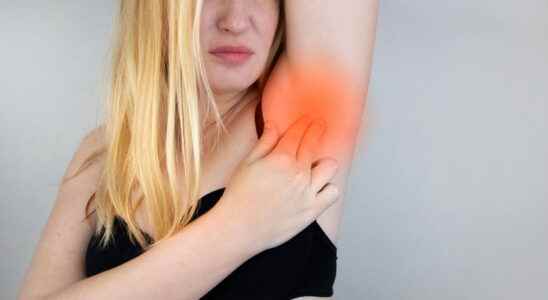Armpit irritation causes shaving what to do