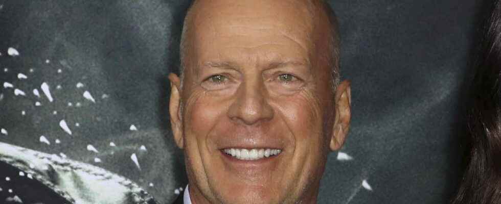 Bruce Willis suffering from dementia how is the actor