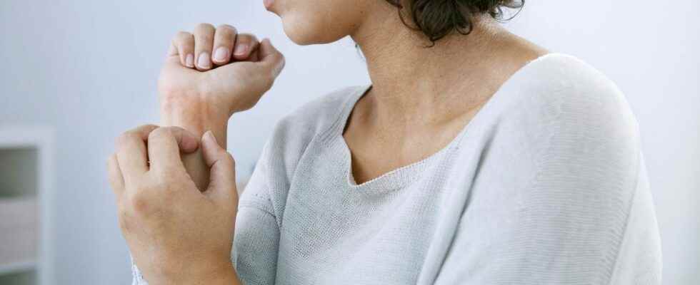 Covid 19 skin rash what are the symptoms