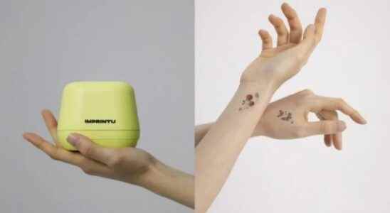 LG Launches Portable Tattoo Machine