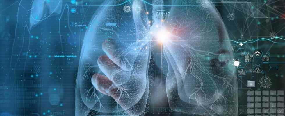 Lung cancer artificial intelligence twice as effective as humans in