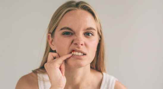 Periodontitis causes symptoms how to treat it