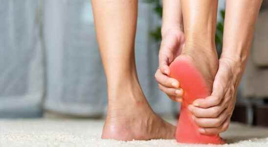 Plantar aponeurosis symptoms soles treatment