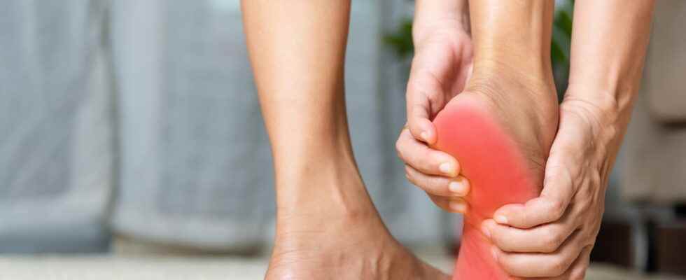 Plantar aponeurosis symptoms soles treatment