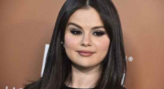 Selena Gomez displays her pimples without complex on Instagram