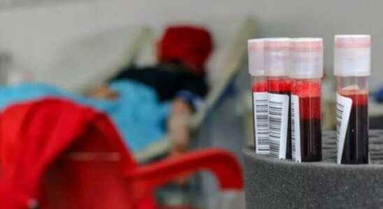 The expert shared Never do before donating blood
