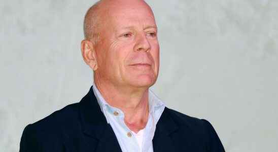 What is frontotemporal dementia this disorder from which Bruce Willis