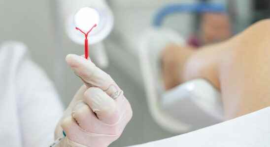 Which hormonal IUDs can cause depression